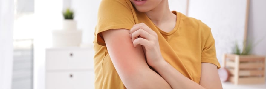 close-up image of someone with eczema on their arm, scratching their skin