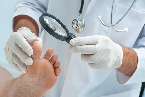 dermatologist examines the foot on the presence of athletes foot